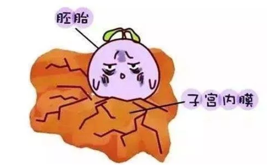 子宮內(nèi)膜太薄是卵巢早衰嗎 導(dǎo)致子宮內(nèi)膜變薄的原因有哪些