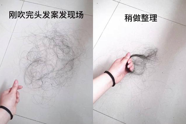 生完孩子為什么容易掉頭發 產后瘋狂掉發怎么護理