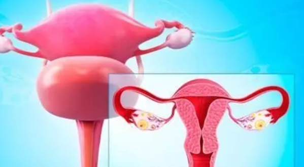 子宮內膜炎有哪些癥狀 子宮內膜炎怎么預防