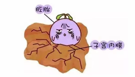 急性子宮內膜炎的發病原因 急性子宮內膜炎嚴重嗎