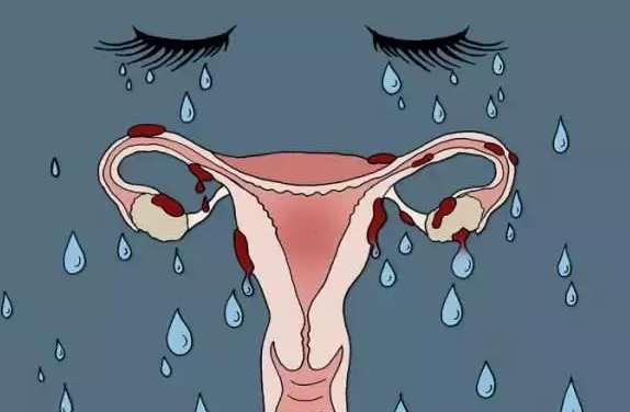 子宮發育不良能治愈嗎 子宮發育不良不來月經怎么辦