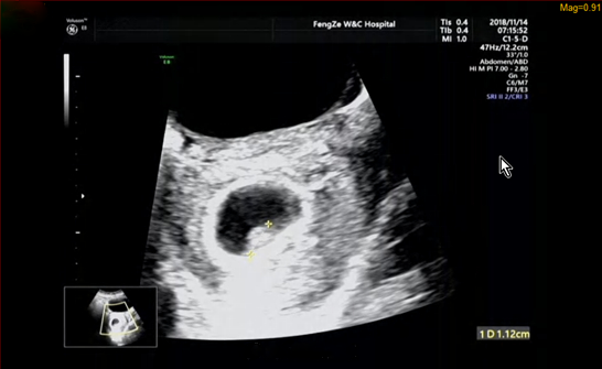 預產期到了心情說說 預產期到了的說說朋友圈