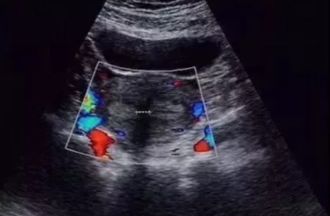 縱膈子宮可以懷孕嗎 縱膈子宮有的危害有哪些