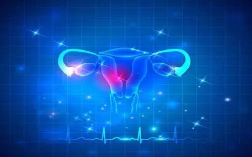 宮腔鏡檢查疼不疼 宮腔鏡檢查能檢查哪些疾病