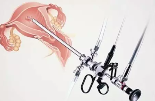 宮腔鏡檢查需要麻醉嗎 宮腔鏡檢查詳細流程