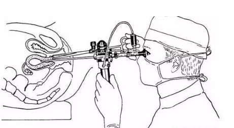 宮腔鏡檢查價格貴不貴 宮腔鏡檢查多少費用