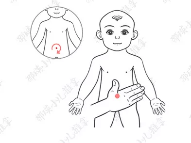孩子小兒疳癥怎么治療 如何用推拿手法治療小兒疳癥