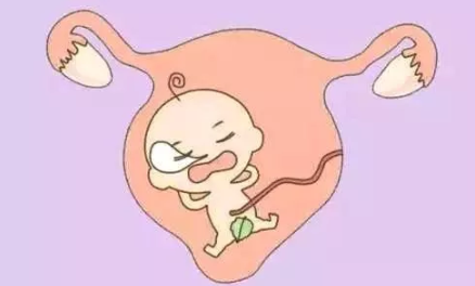 幼稚子宮是什么意思 幼稚子宮是怎么形成的