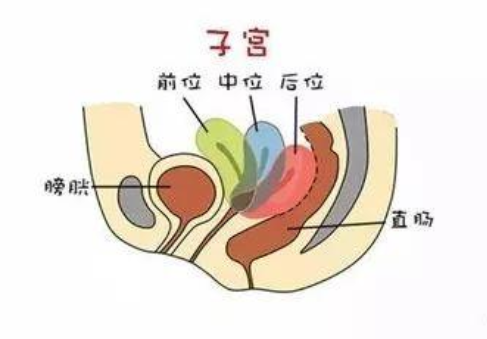 子宮偏小還能懷孕嗎 子宮偏小懷孕的幾率就小嗎