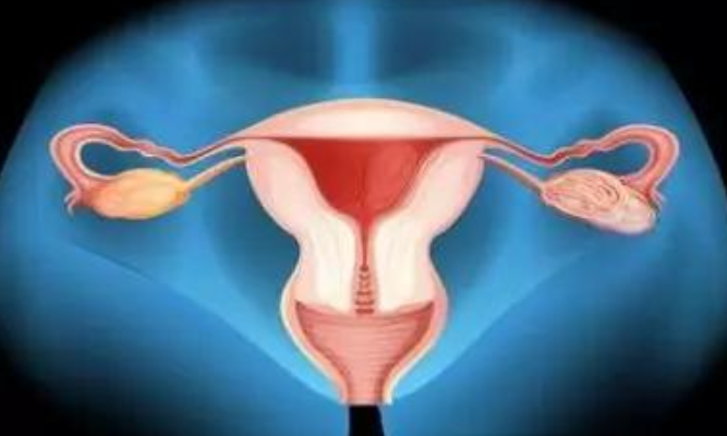 子宮偏小吃什么治療 子宮偏小能治療好嗎