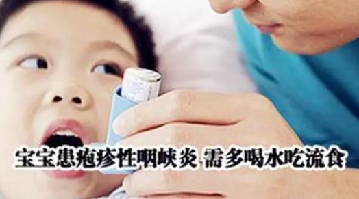 寶寶皰疹性咽峽炎和手足口病區(qū)別 如何預(yù)防小兒皰疹性咽峽炎 寶寶皰疹性咽峽炎和手足口病區(qū)別 如何預(yù)防小兒皰疹性咽峽炎