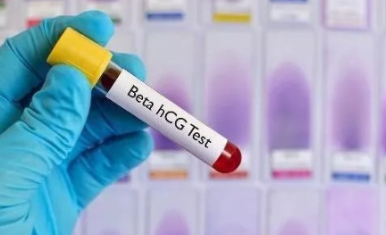 懷孕后HCG正常值是多少 正常妊娠期間血hCG水平