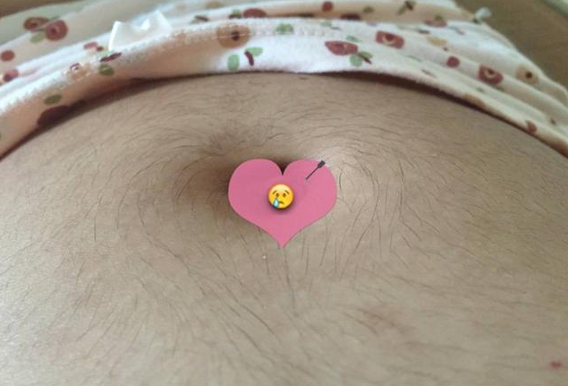 孕期體毛增多正常嗎 懷孕體毛增多是生男孩嗎