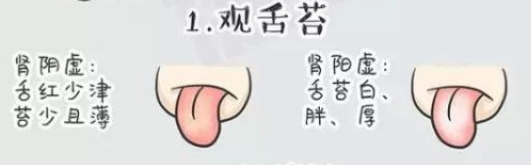 如何判斷陰虛和陽虛 腎陰虛和腎陽虛癥狀區別 如何判斷陰虛和陽虛 腎陰虛和腎陽虛癥狀區別