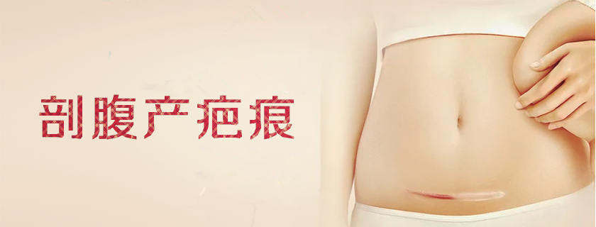 剖腹產疤痕