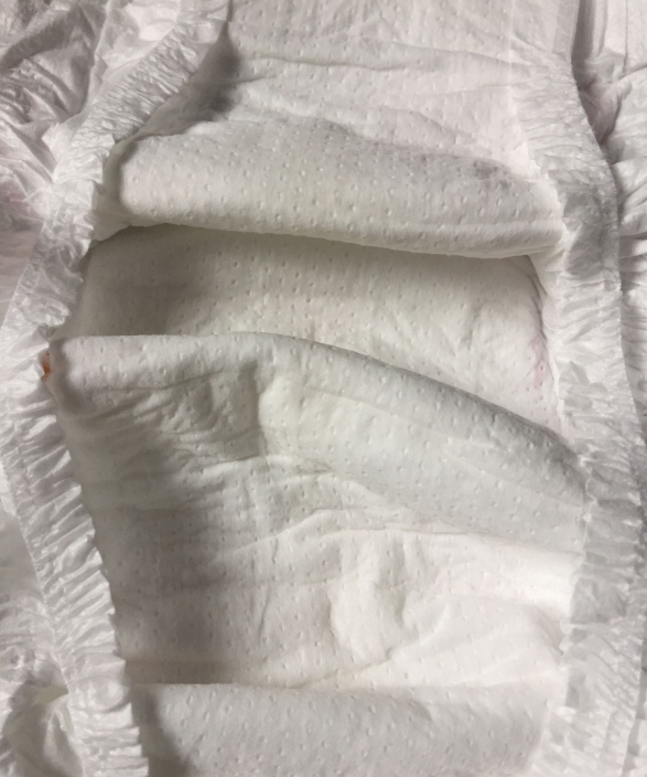 優(yōu)樹纖薄呼吸紙尿褲悶不悶 優(yōu)樹纖薄呼吸紙尿褲孩子用了會紅屁屁嗎