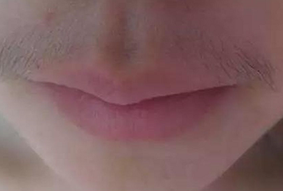 女生為什么會(huì)長(zhǎng)胡子 女生長(zhǎng)胡子怎么解決