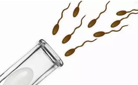 精液不液化的原因是什么 精液發(fā)黃結(jié)塊是怎么回事