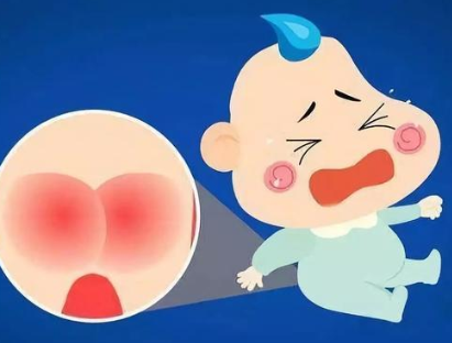 寶寶肛瘺是怎么引起的 寶寶肛瘺是不是嚴重的疾病