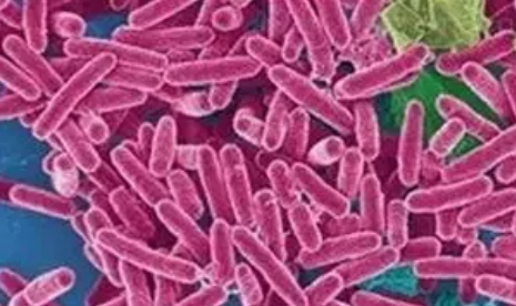 志賀氏菌是是什么疾病 孩子怎么預防志賀氏菌 志賀氏菌是是什么疾病 孩子怎么預防志賀氏菌