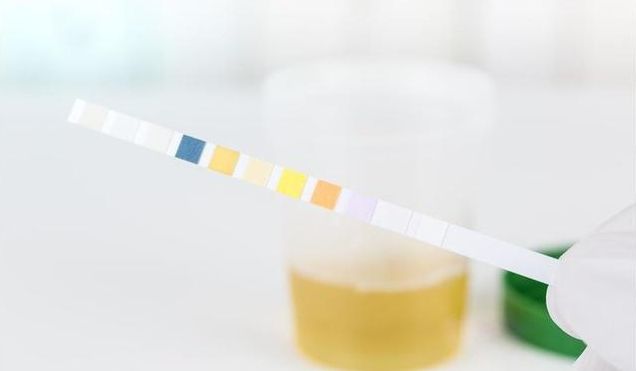 驗孕棒和早孕試紙哪個更快知道懷孕 早孕試紙多久能測出懷孕