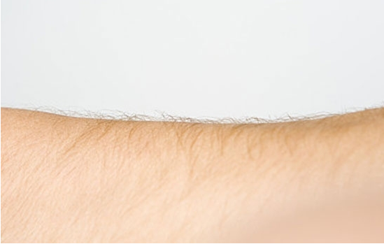 女性體毛越多性欲越強嗎 女性體毛多是為什么 女性體毛越多性欲越強嗎 女性體毛多是為什么