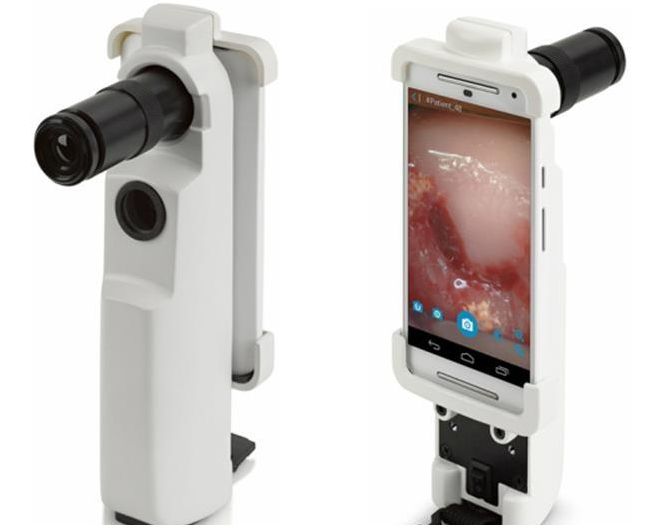 沒有性生活能做陰道鏡嗎 做陰道鏡痛嗎 沒有性生活能做陰道鏡嗎 做陰道鏡痛嗎