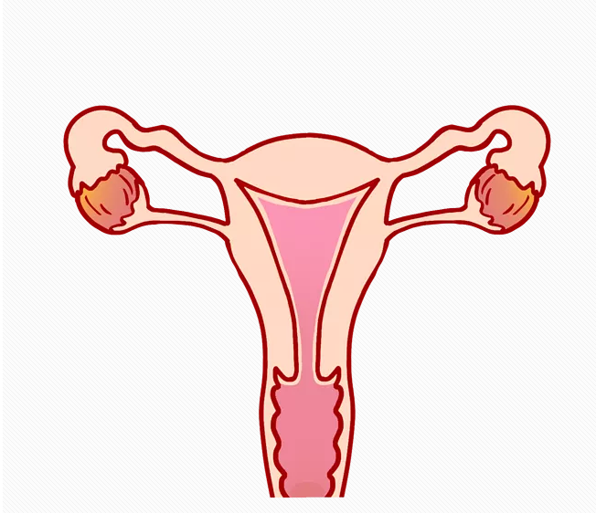 輕度子宮脫垂需要治療嗎 子宮脫垂如何自我檢查 輕度子宮脫垂需要治療嗎 子宮脫垂如何自我檢查