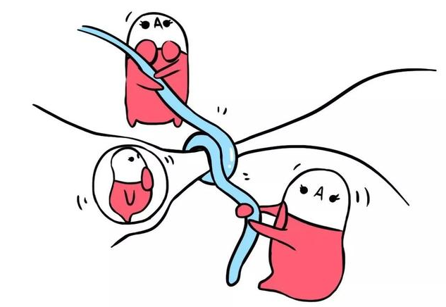 女性結扎容易得婦科病嗎 女性結扎的一般流程是什么