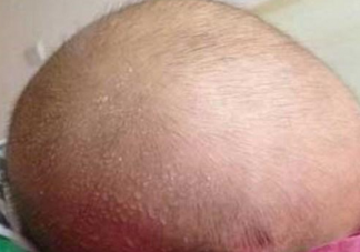 寶寶睡覺為什么總是流汗 寶寶晚上睡覺流汗多是怎么回事