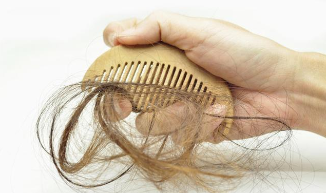 我國脫發人群超2.5億 越來越多年輕人脫發的原因