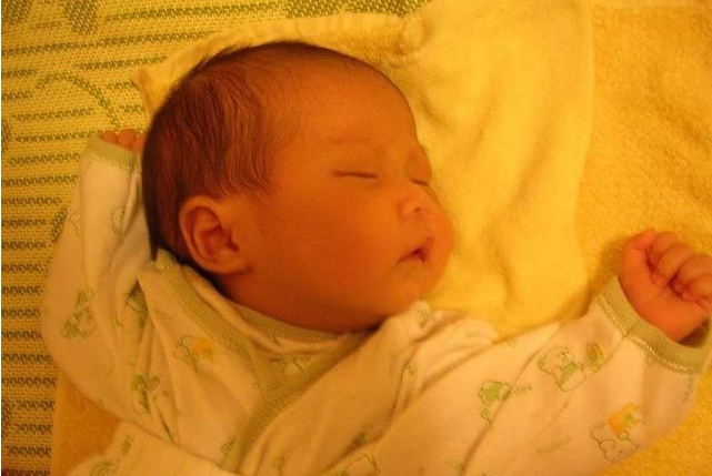 寶寶睡覺總是偏頭是什么原因 孩子睡覺愛偏頭該如何矯正預防