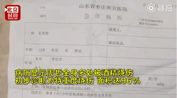 女孩模仿短視頻被重度燒傷是什么情況 模仿易拉罐自制爆米花短視頻被燒傷