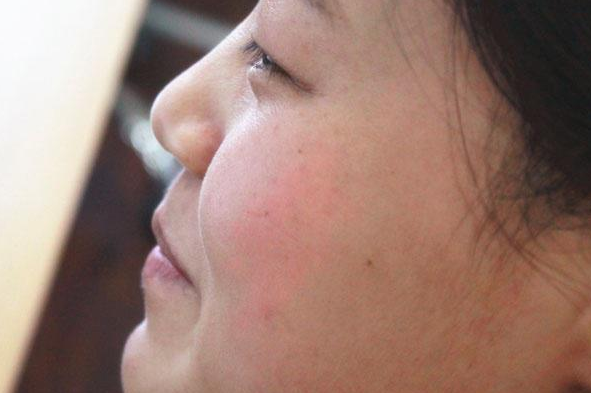 哪些行為習(xí)慣會(huì)導(dǎo)致毛孔粗大 收縮毛孔粗大5個(gè)小方法