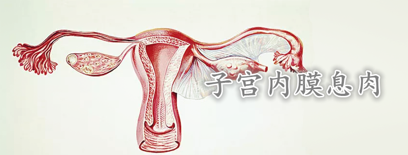 子宮內(nèi)膜息肉患能吃黃體酮治療嗎 子宮息肉可以自然消退嗎