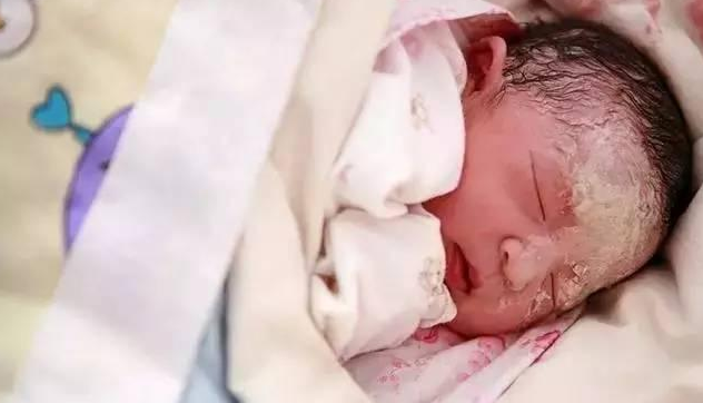 寶寶身上白色的胎脂要不要清除 保留胎脂對寶寶有什么作用 寶寶身上白色的胎脂要不要清除 保留胎脂對寶寶有什么作用