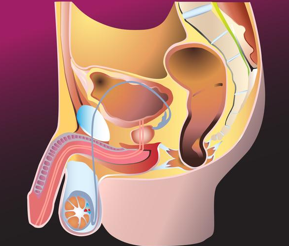 前列腺切除后還有性功能嗎 前列腺切除后有什么影響
