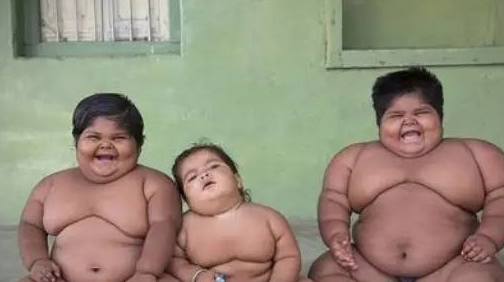 兒童胖到什么程度需要看病 兒童太胖有什么危害