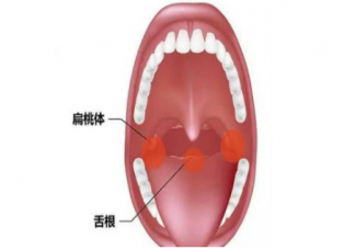 寶寶扁桃體自救指南 怎么保護(hù)孩子扁桃體