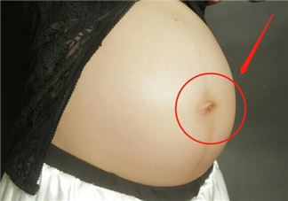 孕婦肚臍眼發黑正常嗎 孕婦肚臍眼發黑如何改善