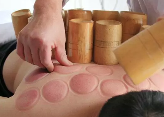 刮痧和拔罐哪個效果好 刮痧和拔罐有什么區別