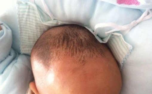 新生兒頭上有臟東西怎么辦 新生兒頭垢怎么清理