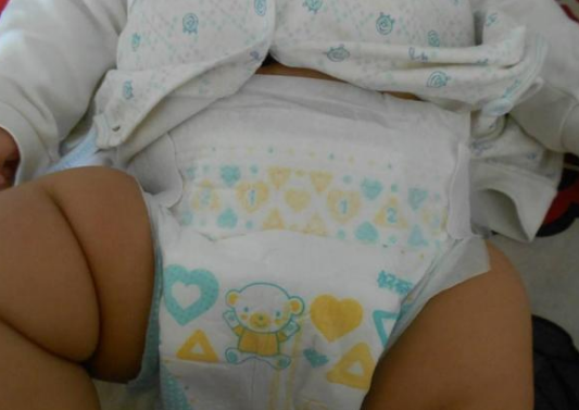 給寶寶綁腿真的能預(yù)防O型腿嗎 要不要給寶寶綁腿 給寶寶綁腿真的能預(yù)防O型腿嗎 要不要給寶寶綁腿