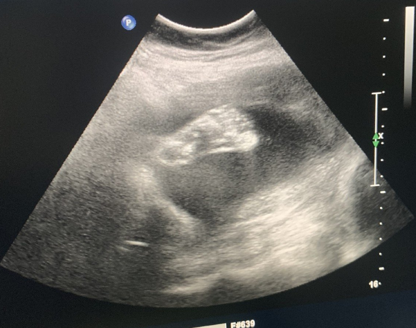 孕晚期累的朋友圈說說 孕晚期感覺很辛苦的心情句子 孕晚期累的朋友圈說說 孕晚期感覺很辛苦的心情句子