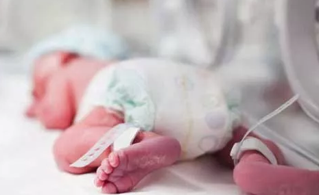 早產寶寶應該怎么照顧 早產兒的照顧方法