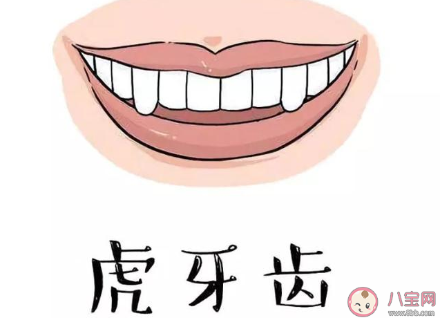 虎牙是怎么形成的 虎牙可以拔除嗎