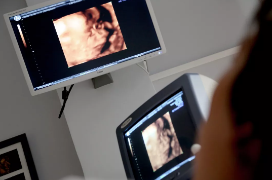 產檢時胎兒過小是怎么回事 胎兒過小該怎么辦