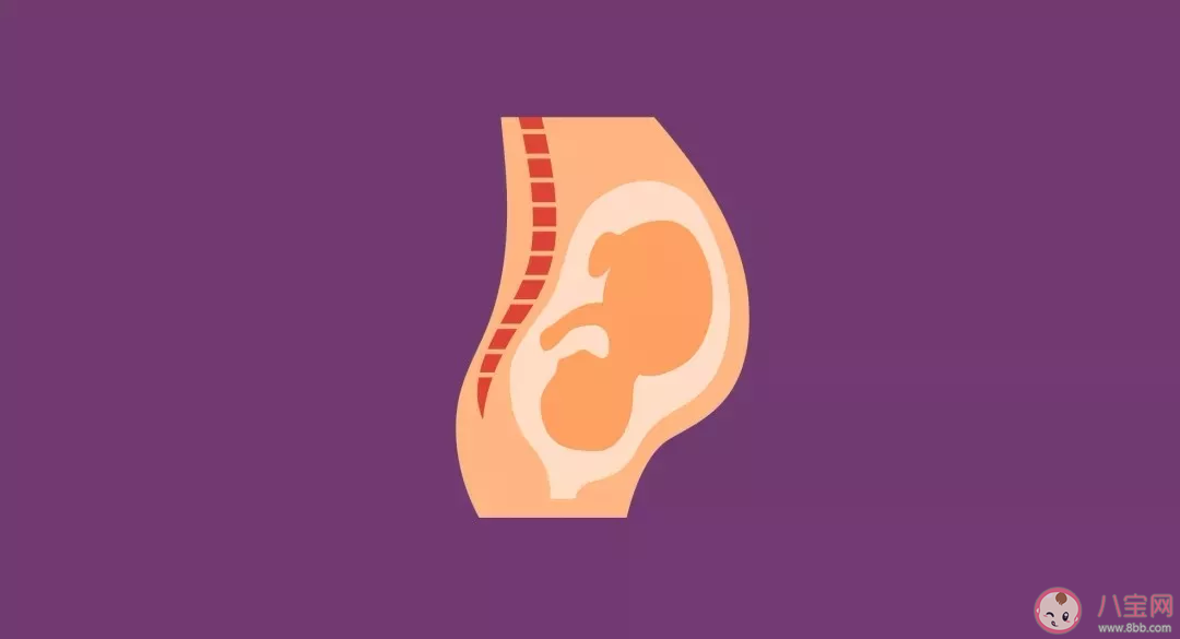 出現羊水栓塞只能剖宮產嗎 平時應該怎么避免羊水栓塞