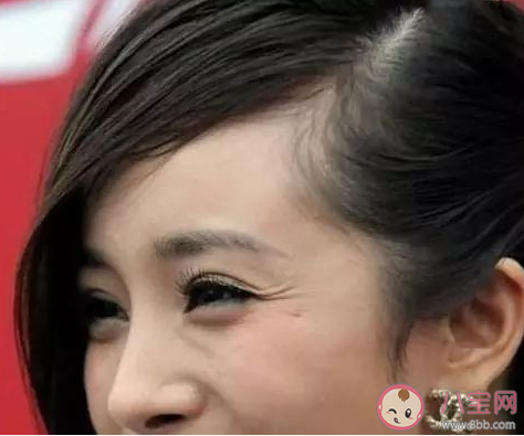 割眼袋會有什么風險 做眼袋手術會有后遺癥嗎