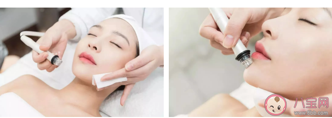 醫(yī)美小氣泡多少錢一次 做小氣泡有什么作用 醫(yī)美小氣泡多少錢一次 做小氣泡有什么作用